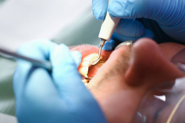 Best Emergency Cosmetic Dentistry in Lumberton, NC
