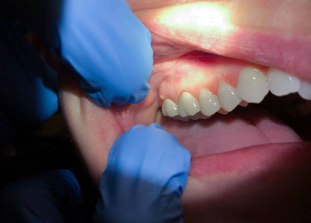 Best Mobile Emergency Dentist in Lumberton, NC